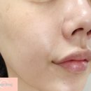 메디로지아 HCC크림 가려움증에 좋은 120시간 보습