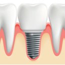 로운치과의원 이미지