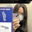 역삼약국 | 강남 역삼 편평사마귀 제거 다빼자패키지 무제한 33만원 내돈내산 후기