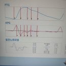 누가한의원 | [분당야탑한의원]아옳이 남친님 한의원에서 다이어트 환 &amp;고주파침치료 받은 내돈내산 솔직후기