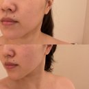 위뷰티 용산점 | 위뷰티 용산점 10000% 내돈내산 후기들