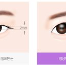 꼼꼼성형외과의원 이미지