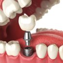 365안락한치과의원 | 울산치과의원 상담 전 확인하면 좋을 사항은