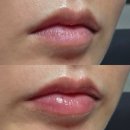 연자로지선 | [품절] 뉴스킨 뉴컬러 펩타이드 파우트 후기｜한정판 재입고 알림