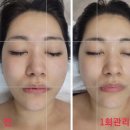 옥길동피부샵 ”제이지니테라피“ 수기윤곽관리 솔직후기 전후비교