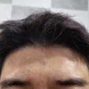 제주 외도동 성형외과 피부과 오늘봄성형외과의원 내돈내산 보톡스 후기