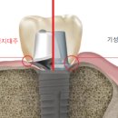 배곧건치과 이미지
