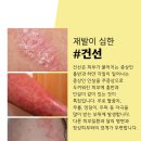 고운누리 이미지