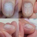 레푸스삼성점 인디고네일 | 가로수길 네일샵 손톱 연장 교정 후기