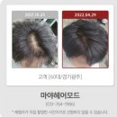 [마야헤어모드] 경기 광주시 경안동의 마야헤어에 가시면 탈모 해결 비법과 두피케어 상담 받을 수...