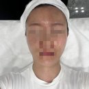 티에스(TS)메디칼 네이버블로그