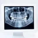 데이봄의원 | 드디어 숙원사업 해결! 내 치아 영구 보존 플랜 시작해봄