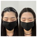 수원-1782 | 수원 헤어라인 고민 크리라인에서 해결한 자신감 회복기