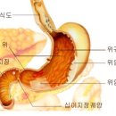 위암의 진단과 치료 이미지