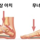 따봉발가락