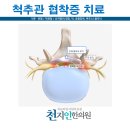 천지인궁한의원 | 척추관 협착증의 천지인 한의원 치료법