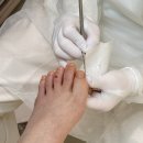 도안동로11번길 | 대전 문제성발톱 잘하는 레푸스 대전도안점에서 내성발톱관리 후기