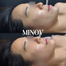 구미대로-24 | 관리] 미노브(MINOV) 에스테틱: 24K 순금으로 독소 싹! 우수미용업소 원장님의 역대급 골드테라피 후기 ✨