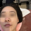 월곡동9 | 광주 월곡동 리즈에서 멜라소닉 화이트토닝 플라관리 받고 온 후기