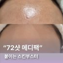 (주)메디바이오템 | 큐어토리 72샷 메디팩, 붙이는 스킨부스터팩 사용 후기