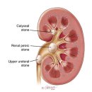 메타제닉스, 신장에 좋아요, 페하를 적절하게 맟추어줍니다, 울트라 클리어 플러스 PH, UltraClear? Plus pH Medical Food 117,000원 이미지