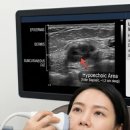 윤곽의정석성형외과 | [부산초음파필러확인제거]내 얼굴 속 필러, 어디에 있을까? 초음파 위치 추적의 정석