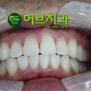 허브치과 이미지