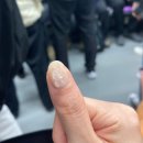 시작될 때는 어느 날 갑자기