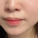 블루 | 트로이아르케 에스테틱 화장품 힐링 칵테일 블루 후기