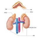 부신피질 기능 항진증(쿠싱병) 이미지