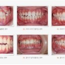 나비치과기공소 이미지