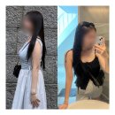 광주피부과 복부지방분해주사 바디제로팻 6회차 찐 후기