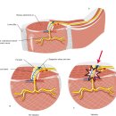 Re: 몸통 신경포착 탐구!! 이미지
