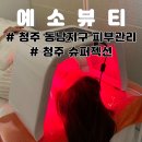 샛골로141번길 24 | 청주 동남지구 피부관리 추천, 예소뷰티 슈퍼젝션 만족스러운 후기