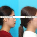 혁신웰치과의원 네이버블로그