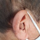 오티콘보청기 강화센터 이미지