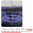 고앤박치과의원 | 용인사랑니치과, 아프지 않게 발치해드리는 TIP