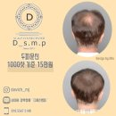 디에스가발
