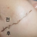 뷰티따뜻스킨