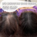 세븐일레븐 화양점 | 모인SMP 여자 탈모 건대두피문신 실제효과 가격 그리고 변화는?