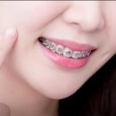 아삭플란트치과의원 이미지
