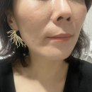 건강하소 | 삼성역 피부과 앞볼필러 받고 온 후기 남겨요