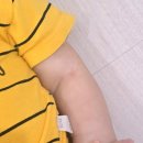 성모약국 | 아기아토피 부산성모병원 소아과 진료 후기, 6개월 동안 5번 진료 본 경과 기록