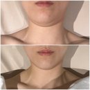 GS25 부전영광점 | 부산웨딩관리 가봄더라인 부산전포점 울트라갸름젯 내돈내산