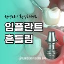 임플란티아치과의원 충주점 네이버블로그