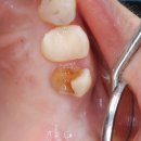 마노메디칼 이미지