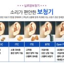 실로암보청기 이미지