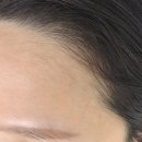 마곡중앙내과의원 | [솜왁싱 마곡점] 결혼 전 깔끔한 이마 만들기 내돈내산 후기!!!_마곡왁싱 마곡역왁싱 추천