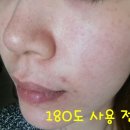 뉴스킨 180도 효과, 후기(한세트)