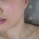 바디스킬릴리즈(오전) | 주안 뉴벨라에스테틱 스페셜 윤곽관리 후기